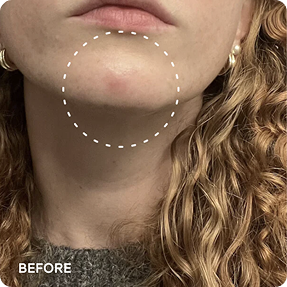 Renewal & Rejuvenation Toner Pads